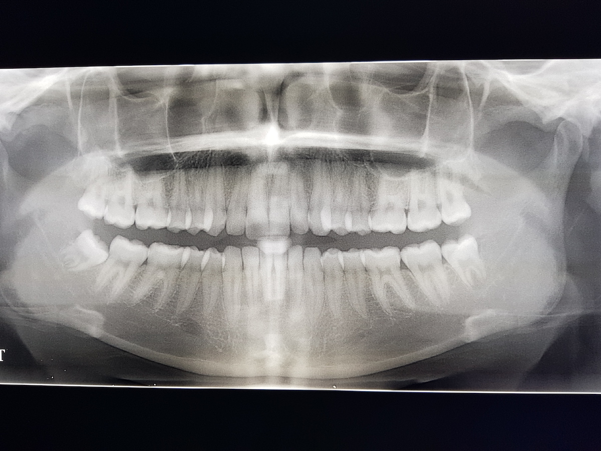 radiologie dentaire